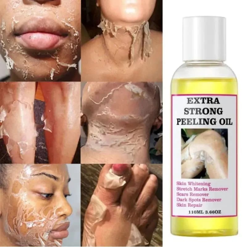 روغن لایه بردار قوی بدن مویام مدل EXTRA STRONG PEELING OIL — تصویر ۳