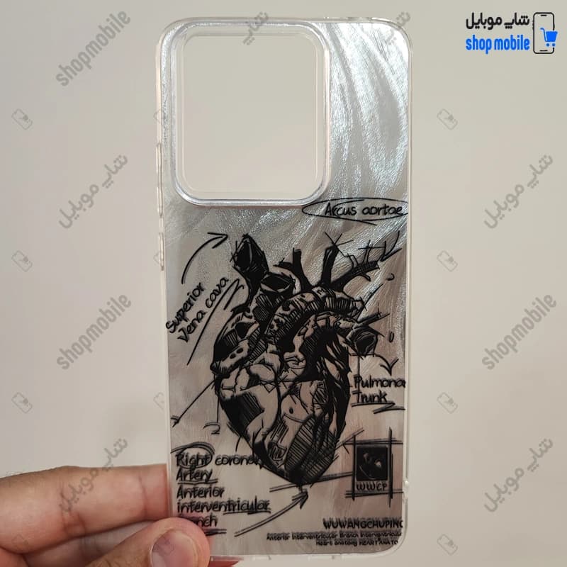 قاب گوشی شیائومی ردمی نوت 14 4G (کاور IMD براش طرح آناتومی قلب Silver)