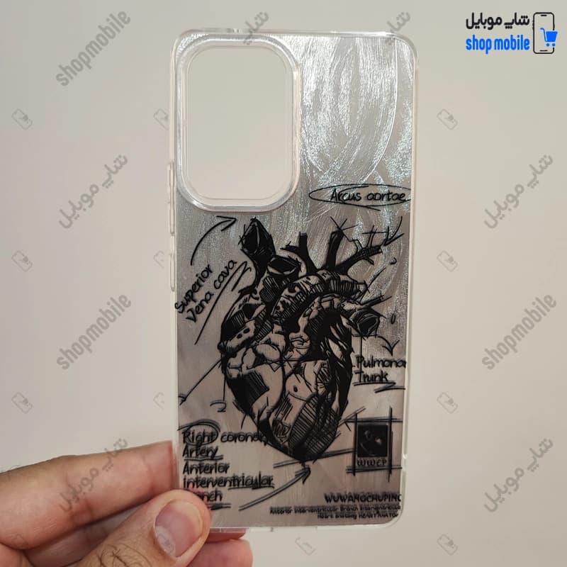 قاب گوشی شیائومی ردمی نوت 11 پرو (کاور IMD براش طرح آناتومی قلب Silver)