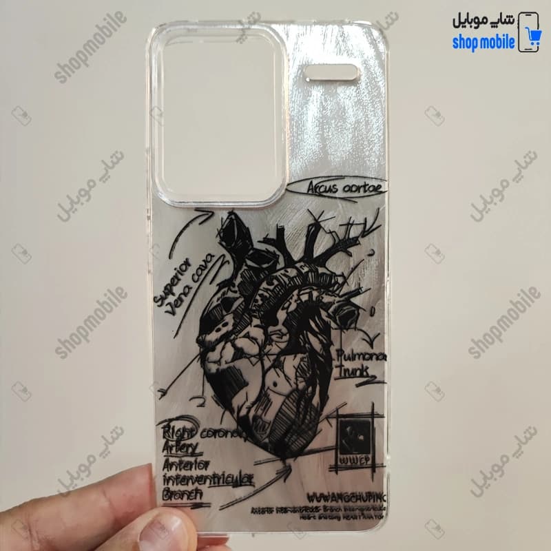 قاب گوشی شیائومی ردمی نوت 13 پرو پلاس 5G (کاور IMD براش طرح آناتومی قلب Silver)