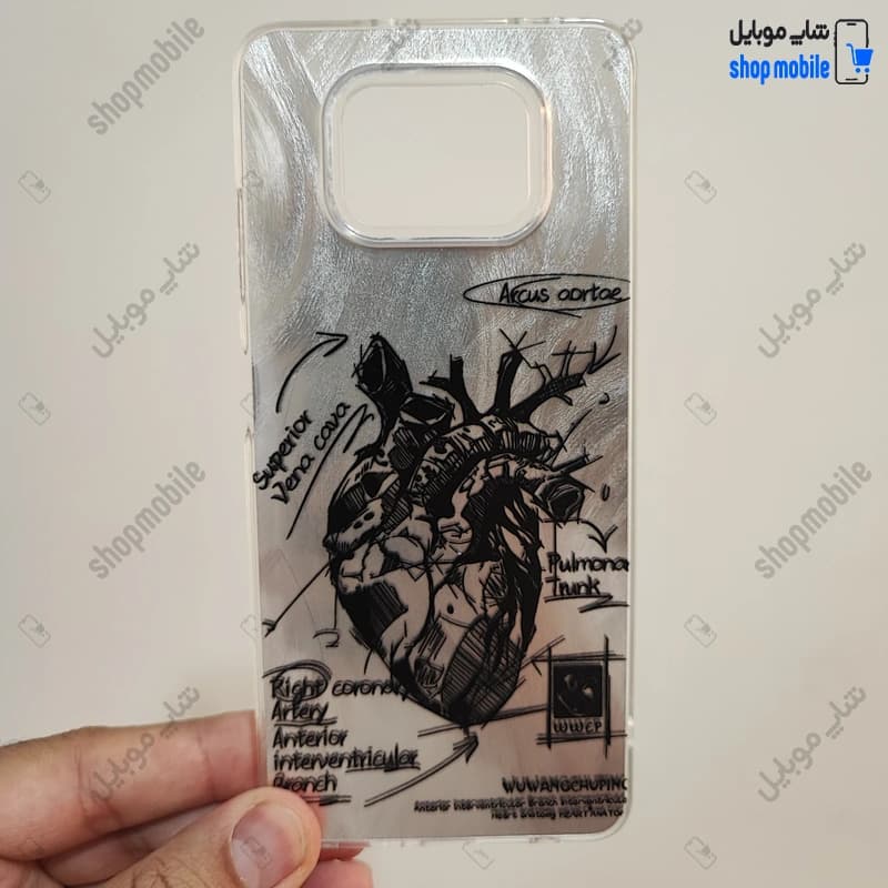 قاب گوشی شیائومی پوکو X3 / X3 پرو / X3 NFC (کاور IMD براش طرح آناتومی قلب Silver)