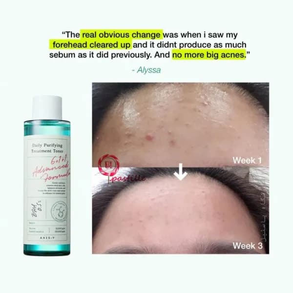 تونر ضدجوش و پاکسازی کننده پوست درمانی اکسیس وای | اصل — تصویر ۴