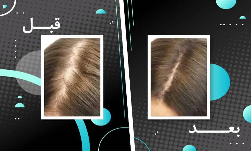 کپسول تقویت مو و ناخن فیتو فانر بسته 120 عددی — تصویر ۶