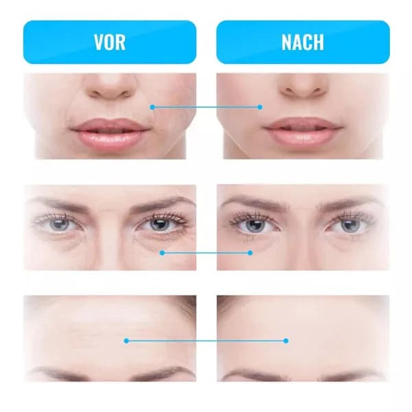 دستگاه میکروکارنت خانگی برند گس GESS — تصویر ۸