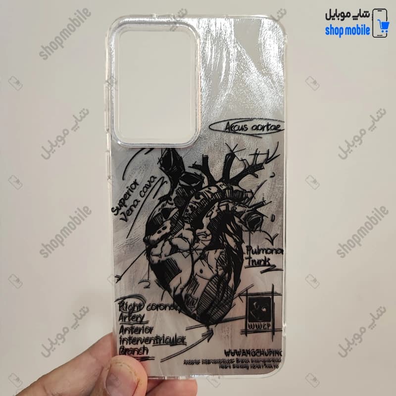 قاب گوشی شیائومی ردمی 12 (کاور IMD براش طرح آناتومی قلب Silver)