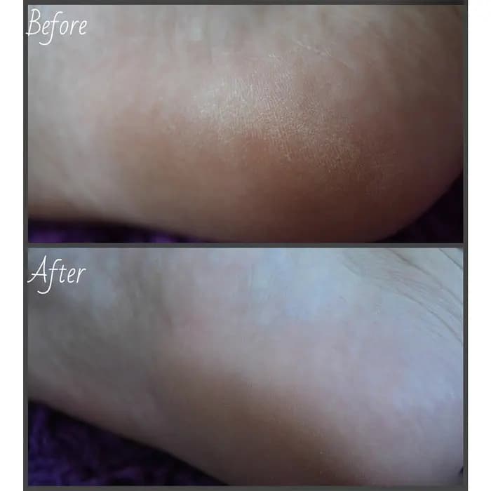 ماسک پا پیوردرم با عصاره لیمو Purederm Foot Peeling Mask — تصویر ۲