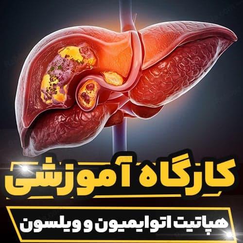 کارگاه آموزشی هپاتیت اتوایمیون و ویلسون