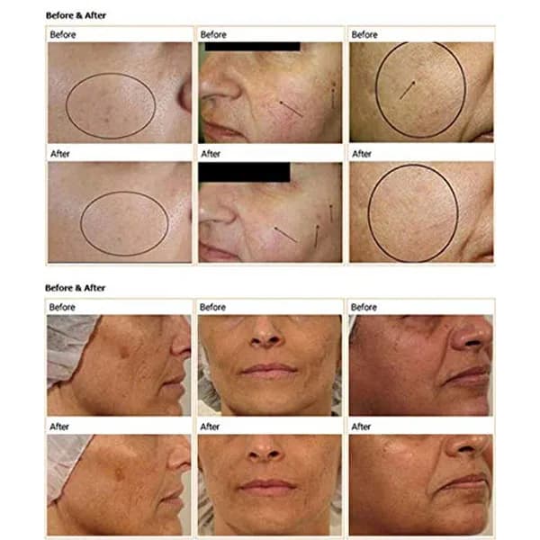دستگاه پلاژن سه هندپیس برند های کوالیتی High Quality — تصویر ۸