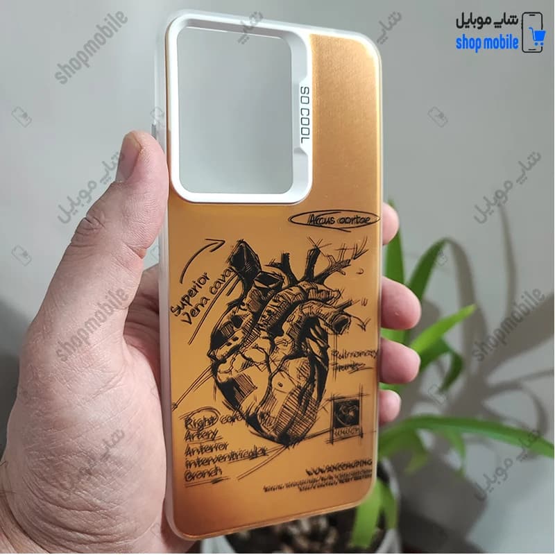 قاب گوشی شیائومی ردمی نوت 12 4G (کاور فانتزی So Cool طرح آناتومی قلب رنگ طلایی)