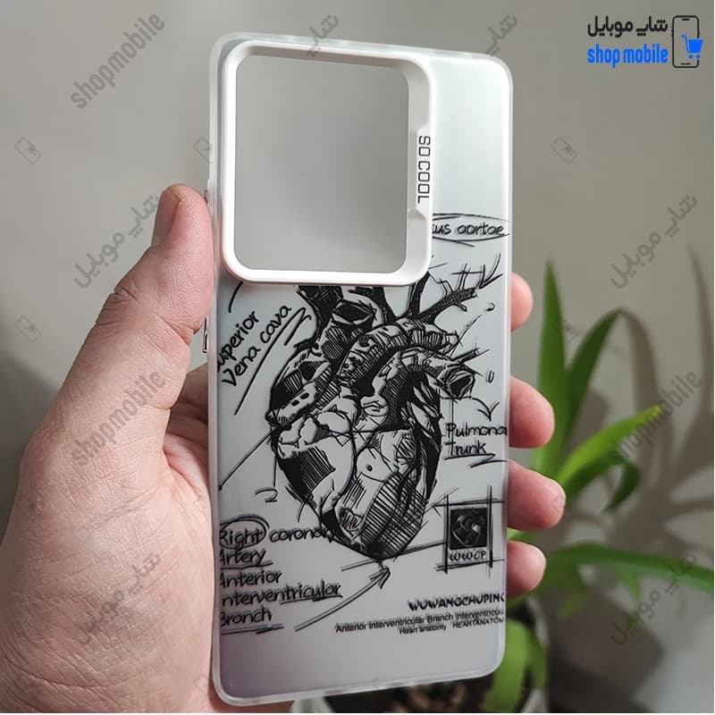 قاب گوشی شیائومی ردمی نوت 14 4G (کاور فانتزی So Cool طرح آناتومی قلب Silver)