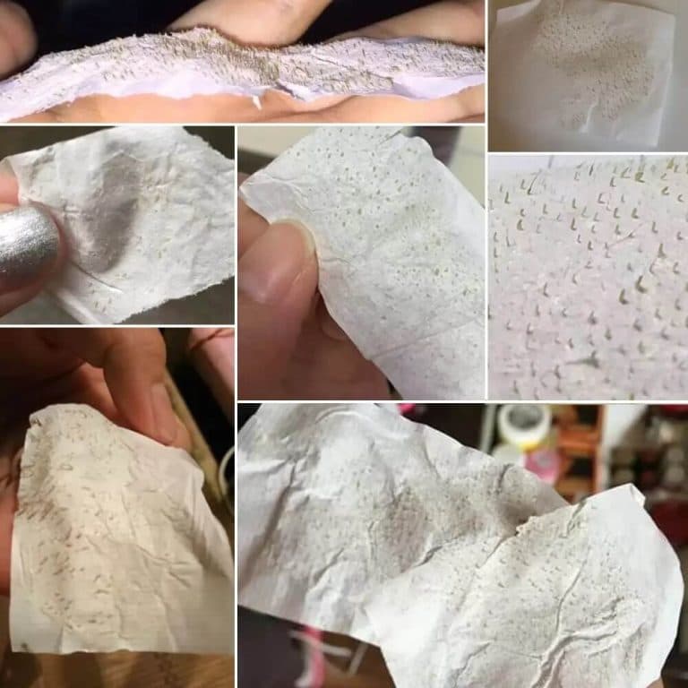 چسب از بین برنده جوش سر سیاه بینی مارک لانبنا LANBENA — تصویر ۳