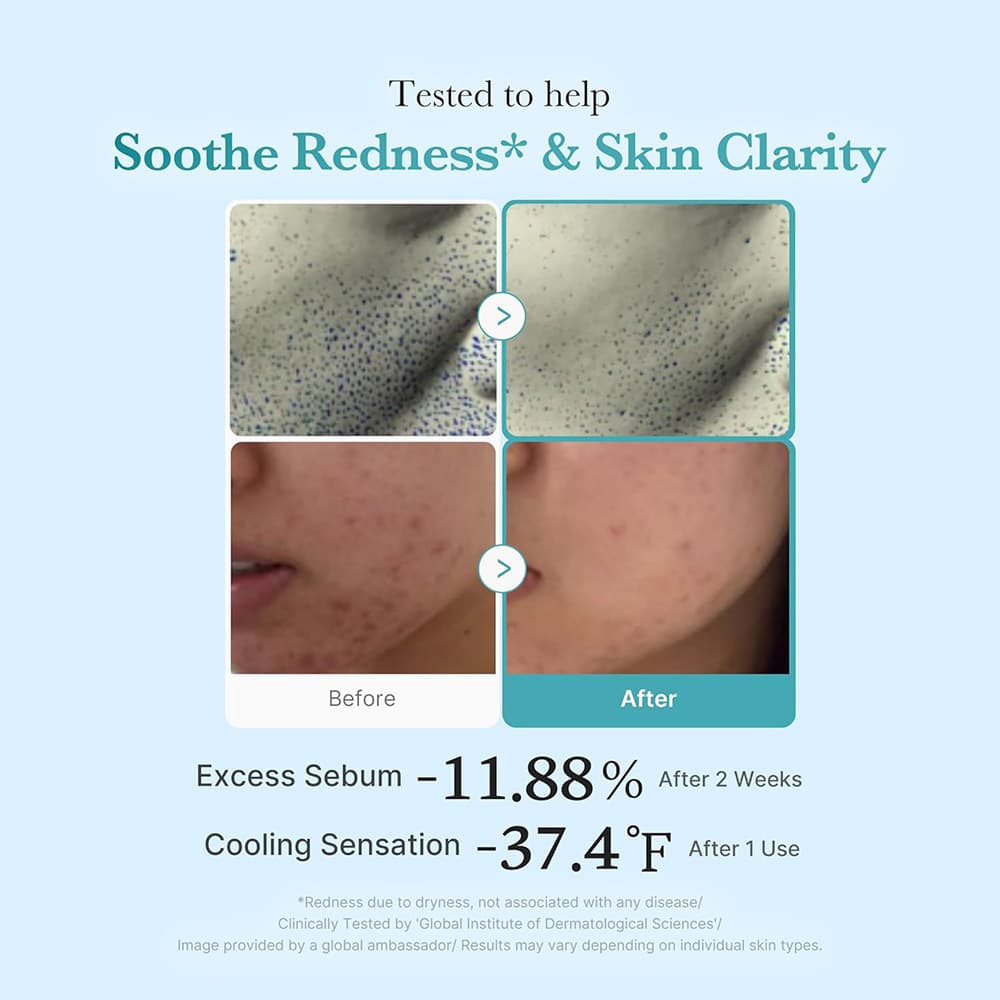 تونر ضد التهاب و روشن کننده پوست آزلائیک اسید و نیاسینامید مدیکیوب Medicube Azelaic Acid Niacinamide Toner حجم 250 میلی لیتر — تصویر ۷