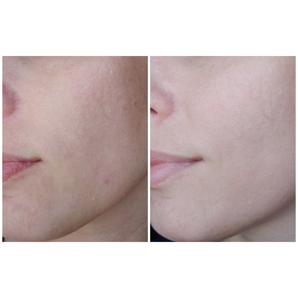 سرم روشن کننده و جوانساز ایدبنون و بلک بری مری اند می Mary & May Idebenone + Blackberry Complex Serum مناسب انواع پوست حجم 30 میلی لیتر — تصویر ۵