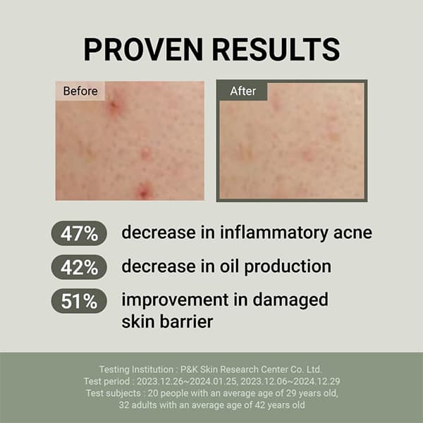 کرم آبرسان پپتاید و حلزون جومیسو Jumiso Snail Mucin 88 + Peptide Facial Cream مناسب انواع پوست به خصوص حساس و مستعد جوش حجم 100 میلی لیتر — تصویر ۵