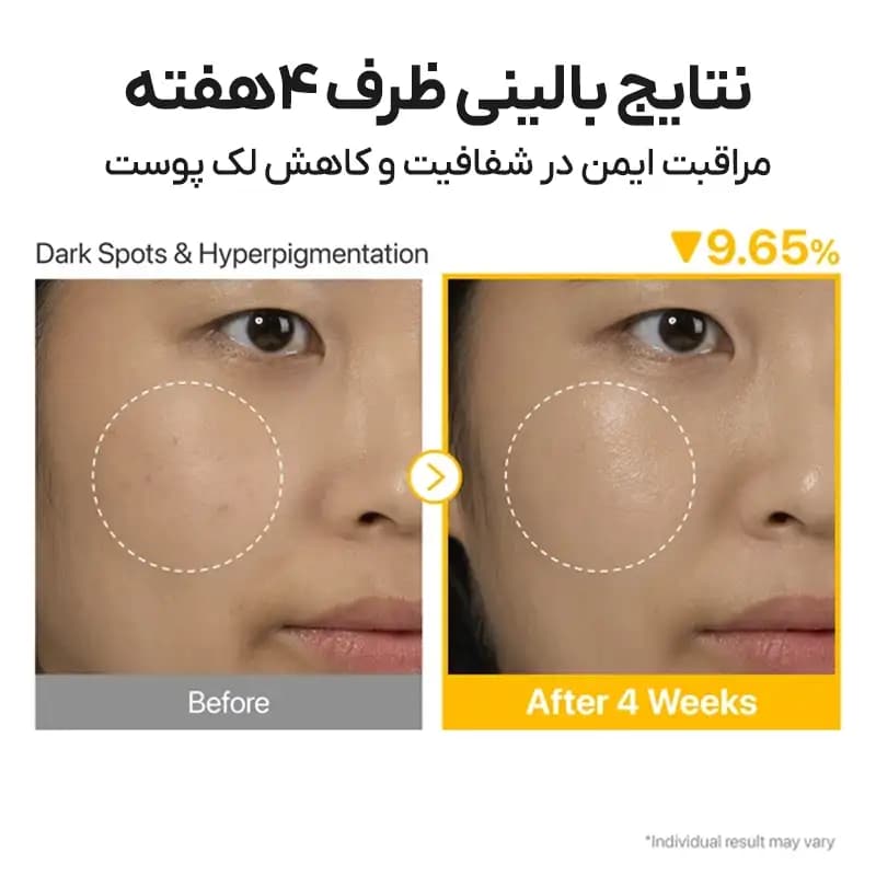 سرم کنسانتره گلوتاتیون نامبوزین Numbuzin شماره 5 حجم 30 میلی لیتر اصل — تصویر ۲