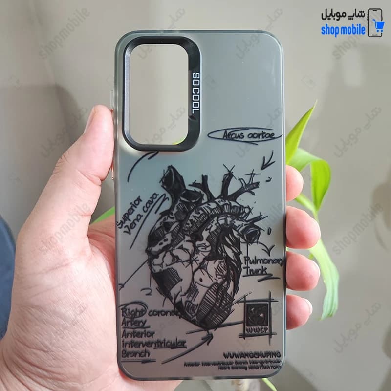 قاب گوشی شیائومی ردمی نوت 11 پرو / نوت 12 پرو 4G (کاور فانتزی So Cool طرح آناتومی قلب)