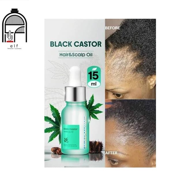روغن مو و پوست سر کرچک سیاه شیگلم 15ml SHEGLAM HAIR Black Castor Hair & Scalp Oil 15ml — تصویر ۲