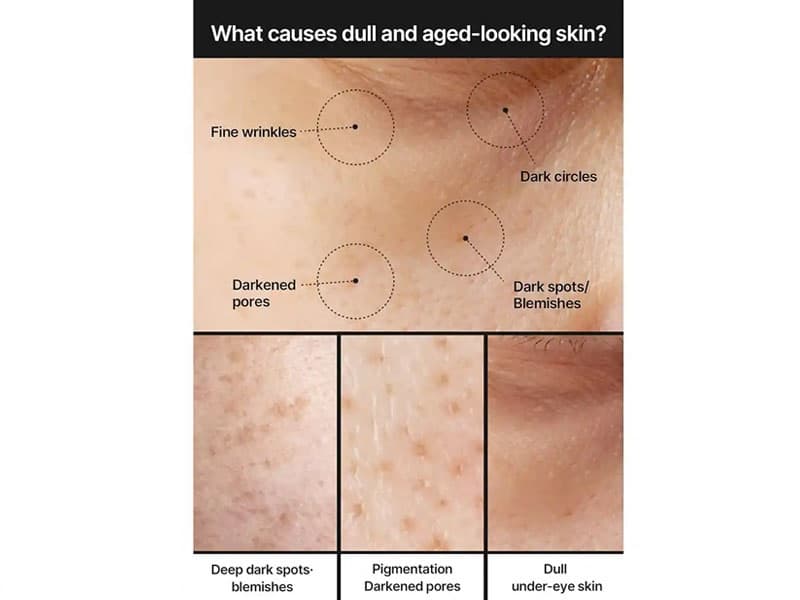 کرم ضد لک و کوچک کننده منافذ سلیمکس Celimax Pore+Dark Spot Brightening Cream مناسب انواع پوست حجم 35 میلی لیتر — تصویر ۵