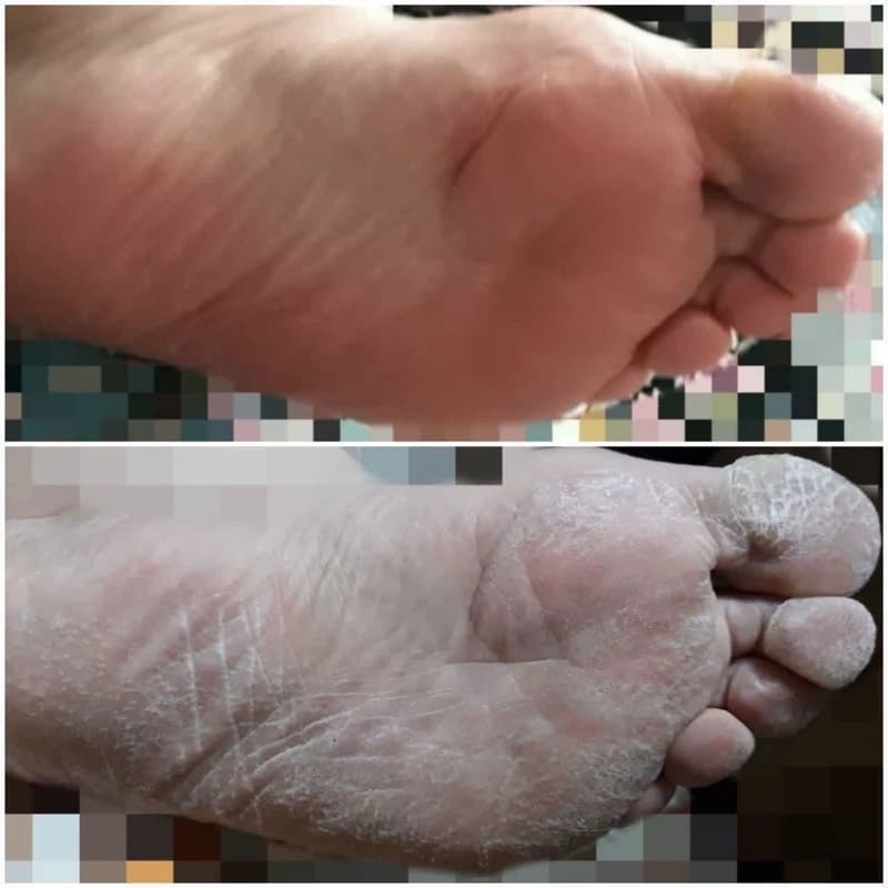 کرم ترک پا ارگانیک — تصویر ۲