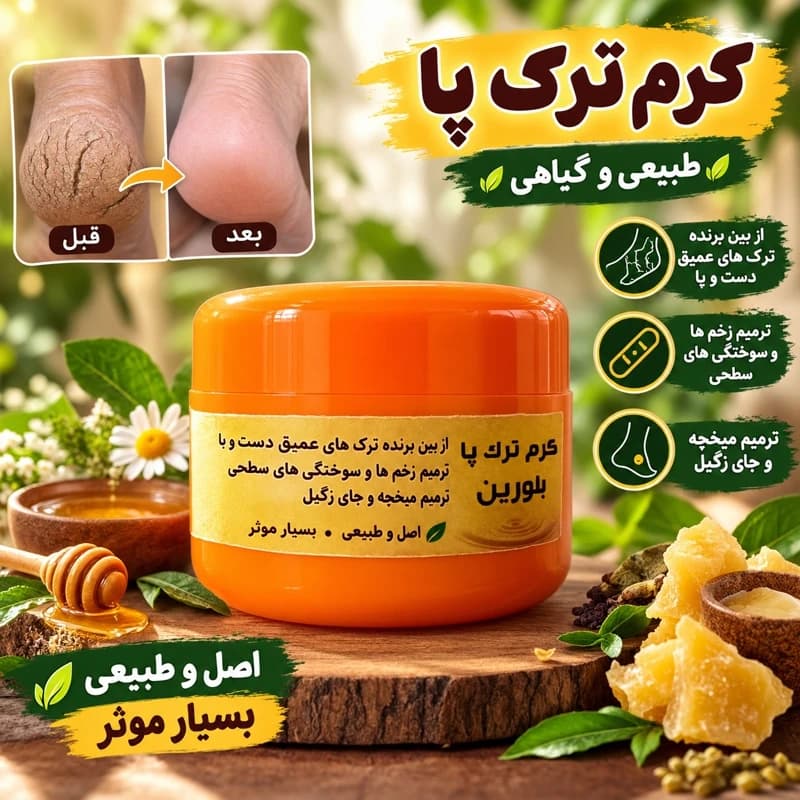کرم ترک پا، از بین برنده ترک های عمیق دست و پا، ترمیم میخچه، ترمیم زخم ها و سوختگی های سطحی