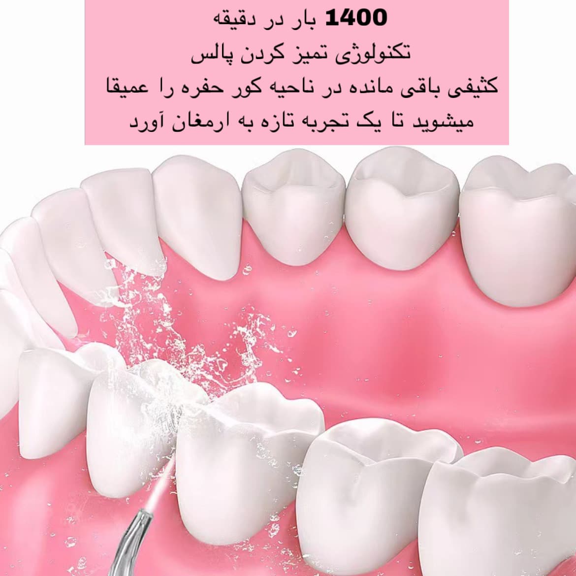 دستگاه شست و شوی دهان و دندان (واتر جت) — تصویر ۶