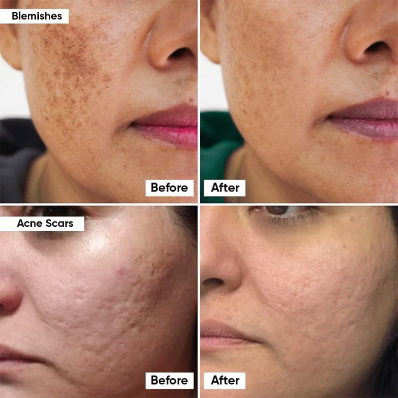 سرم ضد لک نیاسینامید 15% کوزارکس روشن کننده Cosrx The Niacinamide 15 Serumمناسب برای پوست چرب و جوش دار حجم 20 میلی لیتر — تصویر ۲