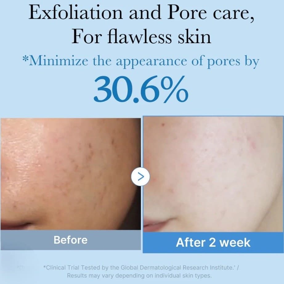 تونر کوچک کننده منافذ Zero Pore مدیکیوب AHA/BHA Toner مناسب پوست چرب، مختلط و مستعد جوش حجم 250 میلی لیتر — تصویر ۶