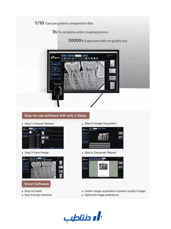 سنسور RVG ایتیس Eighteeth مدل NANOPIX — تصویر ۸