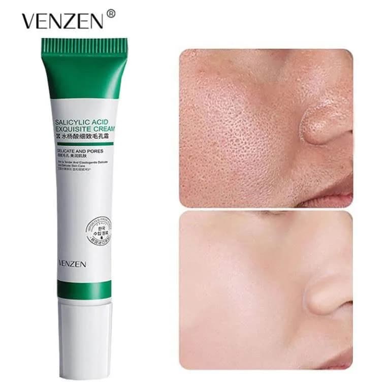 کرم ضد جوش ونزن مدل سالیسیلیک اسید Venzen — تصویر ۲