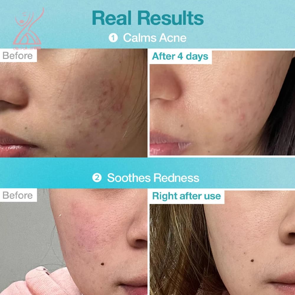 ماسک ورقه ای آبرسان نامبوزین Numbuzin Pantothenic B5 + Hyaluronic — تصویر ۳