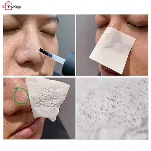 کیت 3 مرحله ای حذف جوش سر سیاه بینی بریلی step1 و step2 — تصویر ۵