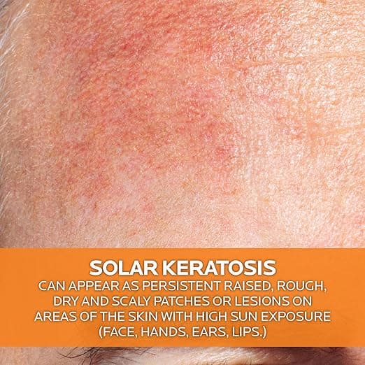 کرم ضدآفتاب لاروش پوزای spf50 مدل Anthelios 100 KA مناسب برای انواع پوست بویژه پوست های حساس حجم50 میلی لیتر — تصویر ۵