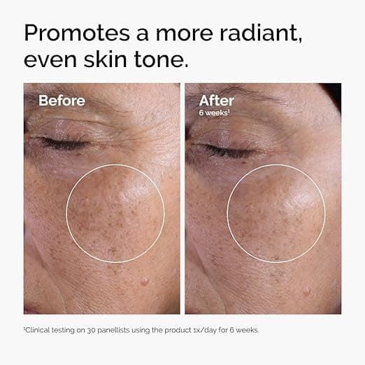 تونر لایه‌بردار گلیکولیک اسید 7٪ اوردینری Glycolic Acid 7% Toning Solution The Ordinaryمدل روشن‌کننده پوست مناسب انواع پوست حجم 240 میلی لیتر — تصویر ۶