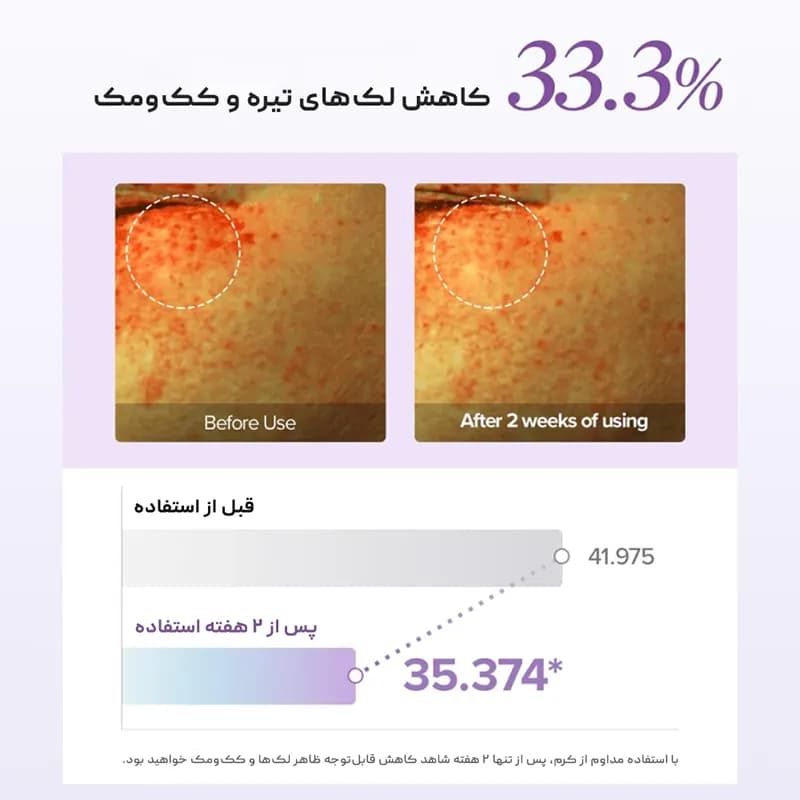 کرم دور چشم گلوتاتیون مری اند می Mary&May — تصویر ۴