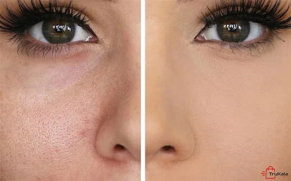سرم صورت ویتامین E مکس لیدی MAX LADY حجم 30 میلی لیتر — تصویر ۳