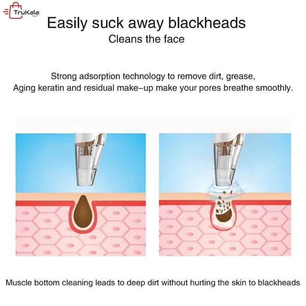 دستگاه میکرودرم پاکسازی بخار دار بلک هد V-benz blackhead — تصویر ۵