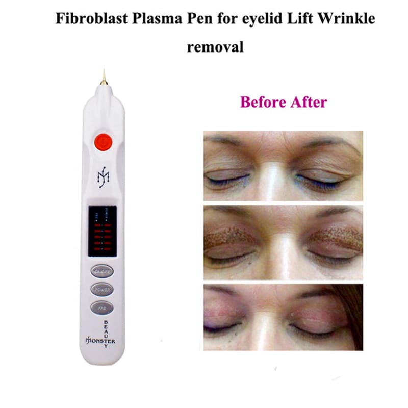 دستگاه پلاسما پن بیوتی مانستر PLASMA BEAUTY PEN MONSTER — تصویر ۷
