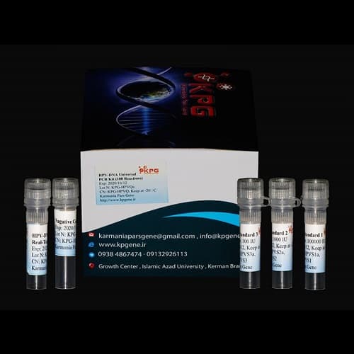 کیت Real-Time PCR برای تشخیص HIV-1 ویروس