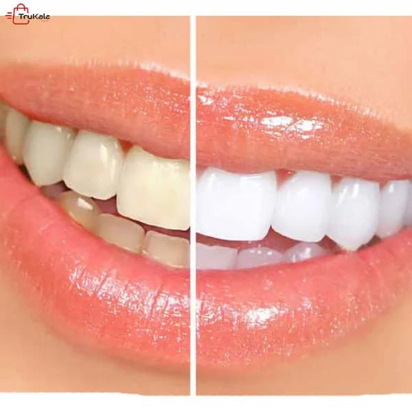 قلم سفید کننده دندان دزلینگ وایت DAZZLING WHITE — تصویر ۴