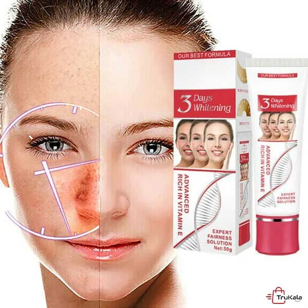 کرم سفید کننده در 3 روز ایچون بیوتی AICHUN BEAUTY — تصویر ۶