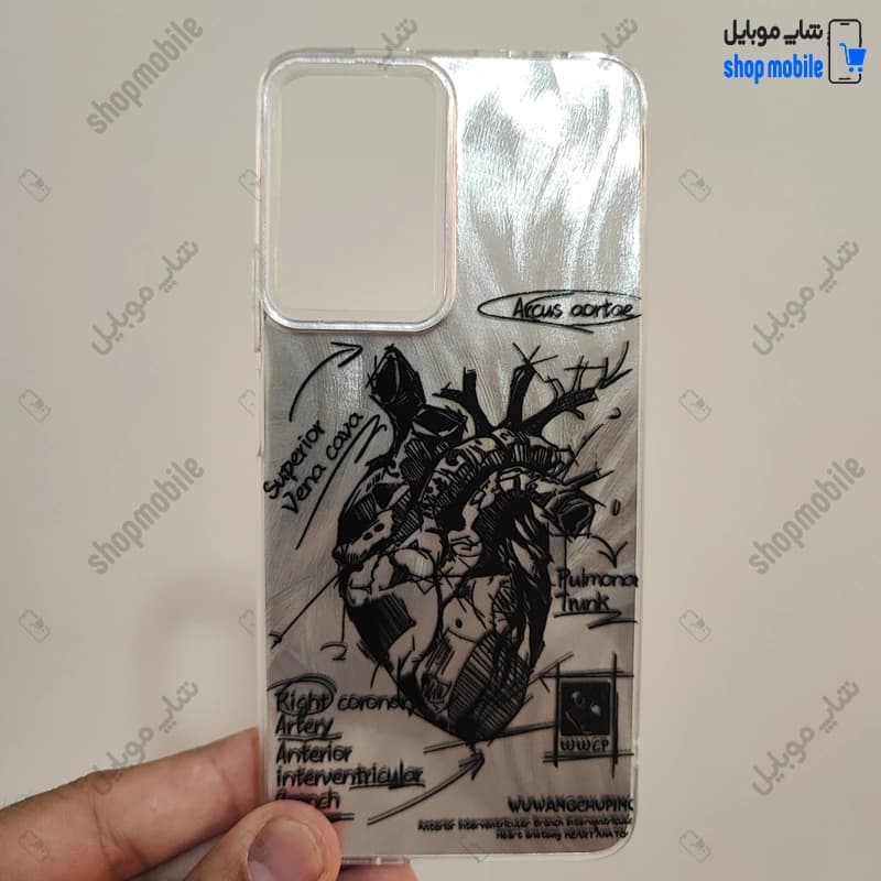 قاب گوشی شیائومی ردمی نوت 14S (کاور IMD براش طرح آناتومی قلب Silver)
