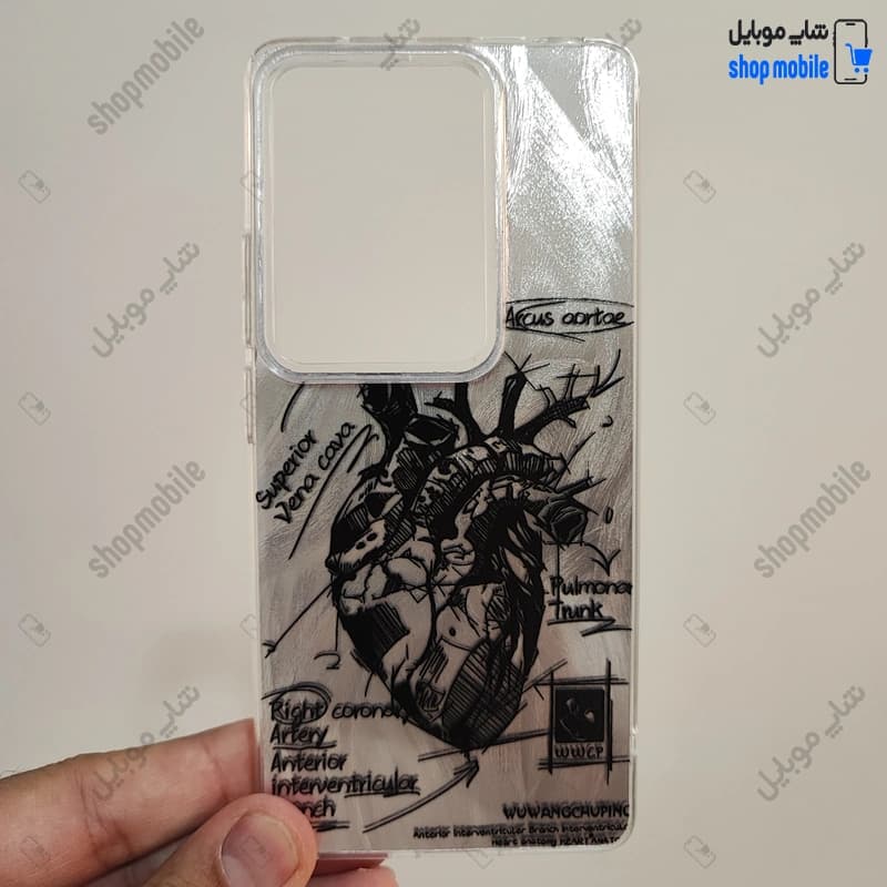 قاب گوشی شیائومی ردمی نوت 13 پرو 4G (کاور IMD براش طرح آناتومی قلب Silver)