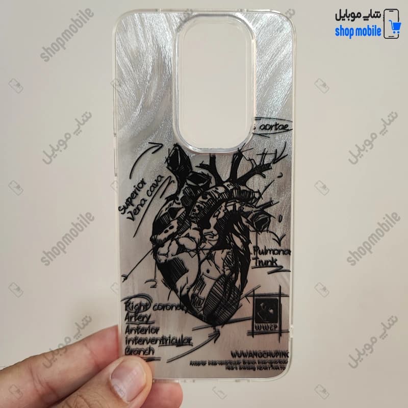 قاب گوشی شیائومی ردمی نوت 8 پرو (کاور IMD براش طرح آناتومی قلب Silver)
