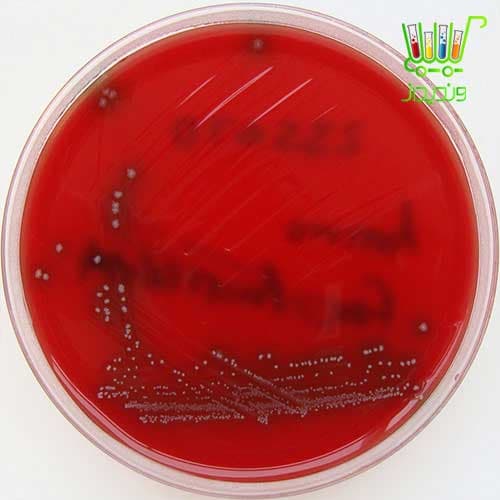 محیط کشت آکتینومایسس آگار – Actinomyces