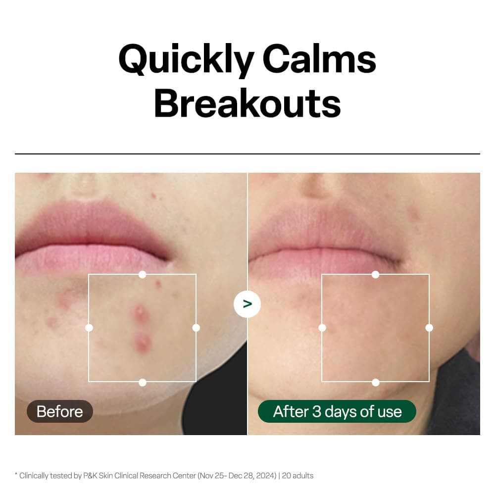 سرم تسکین دهنده التهاب و قرمزی و آبرسان هیال سیکا رد بلمیش دکتر جی Dr.G R.E.D Blemish Clear Hyal Cica Soothing Serum — تصویر ۶