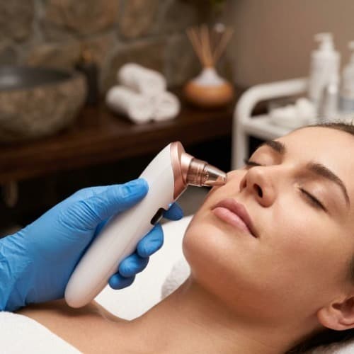 دستگاه میکرودرم و مکنده جوشهای سرسیاه شارژی با ۴ سری تخصصی — تصویر ۶