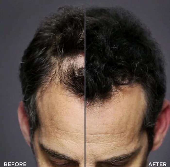 پودر پشت کننده مو تاپیک مدل FIBER وزن 10.3 گرم رنگ قهوه ای متوسط به همراه سری پودر پاش — تصویر ۶