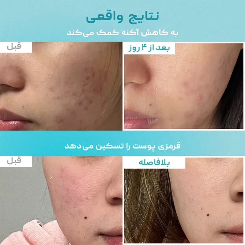 ماسک ورقهای آبرسان شماره 1 نامبوزین Numbuzin — تصویر ۳
