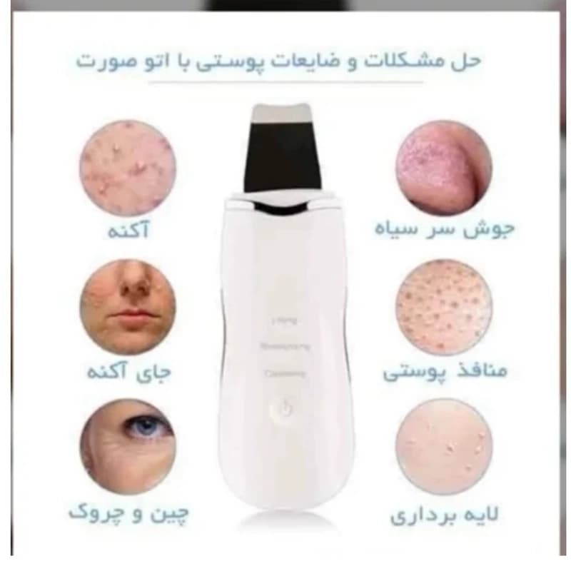 اتو صورت درمااف — تصویر ۷
