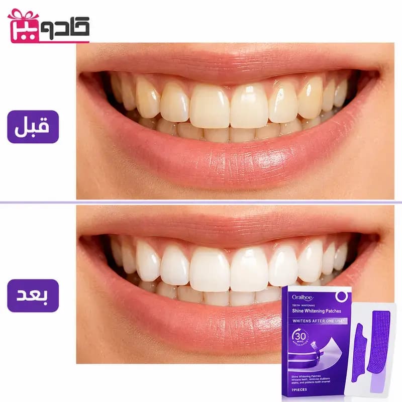 نوار سفیدکننده بنفش دندان اورالهو Oralhoe بسته ۷ عددی — تصویر ۳